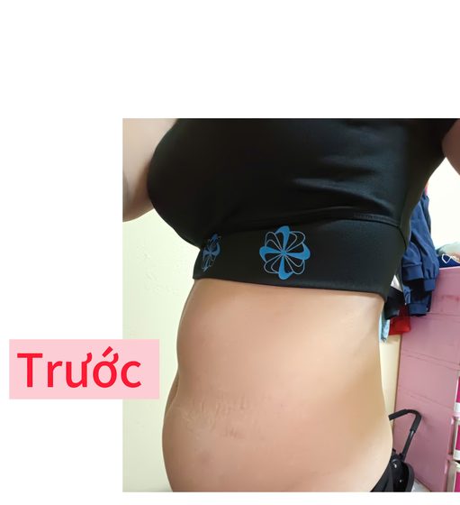 Trước